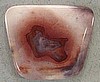 Candy Opal Cabochon